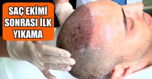 Saç Yıkama